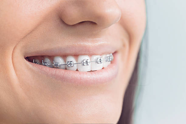 Best Full Mouth Reconstruction  in Mante, CA